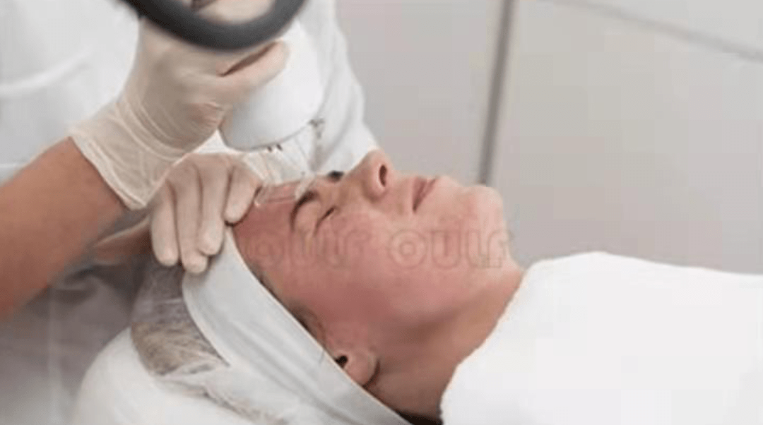 玛吉卡戴珊同款欧洲之星效果怎么样，为什么说欧洲之星效果不太行