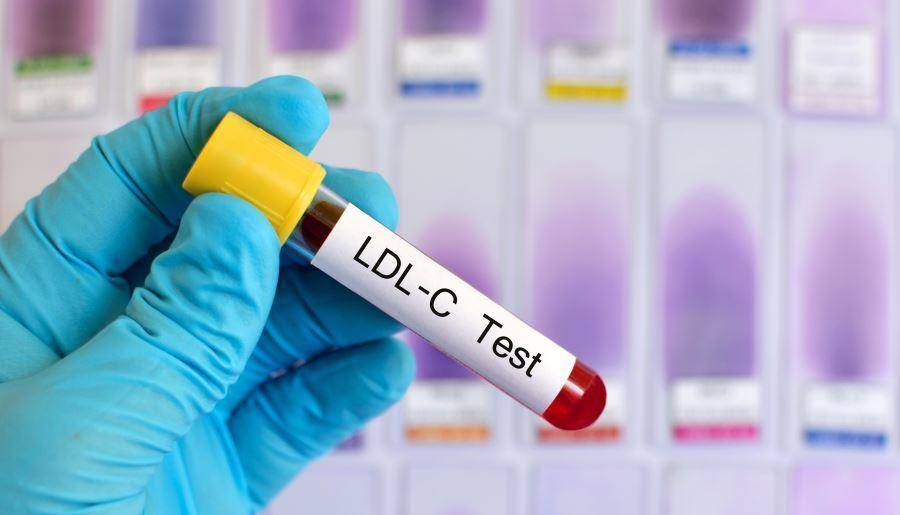 他汀|血脂高了该如何选择“他汀”,怎样选可以避开副作用?医生讲清楚