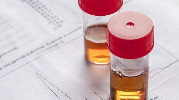 症状|同样是肾病，尿蛋白和潜血哪个更严重？治疗有何不同？