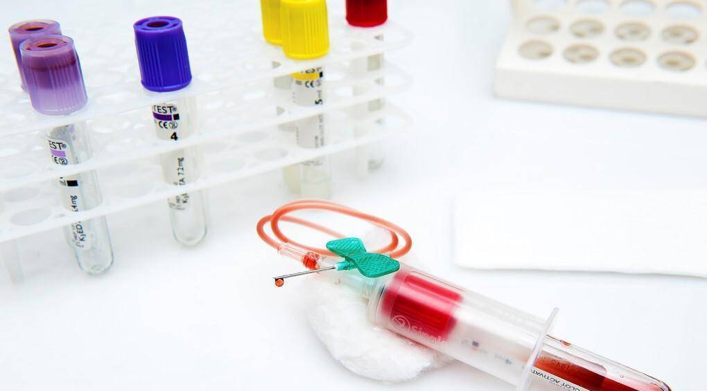 症状|糖尿病的早期，并不都会出现“三多一少”，尿液也不一定会发甜