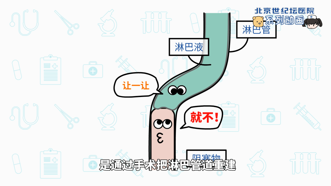 治疗|【科普动画】淋巴管静脉吻合术 术前术后要做啥？