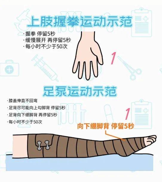 治疗|【科普动画】淋巴管静脉吻合术 术前术后要做啥？