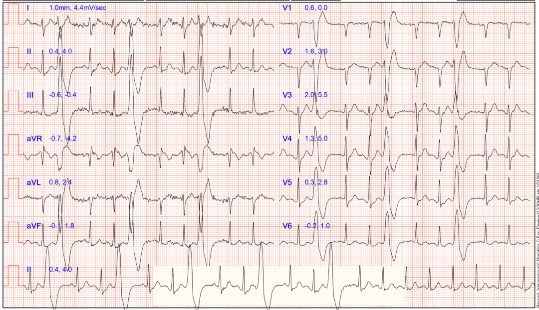 检查|装病？32岁女子一干活就晕倒！婆家人也不理解