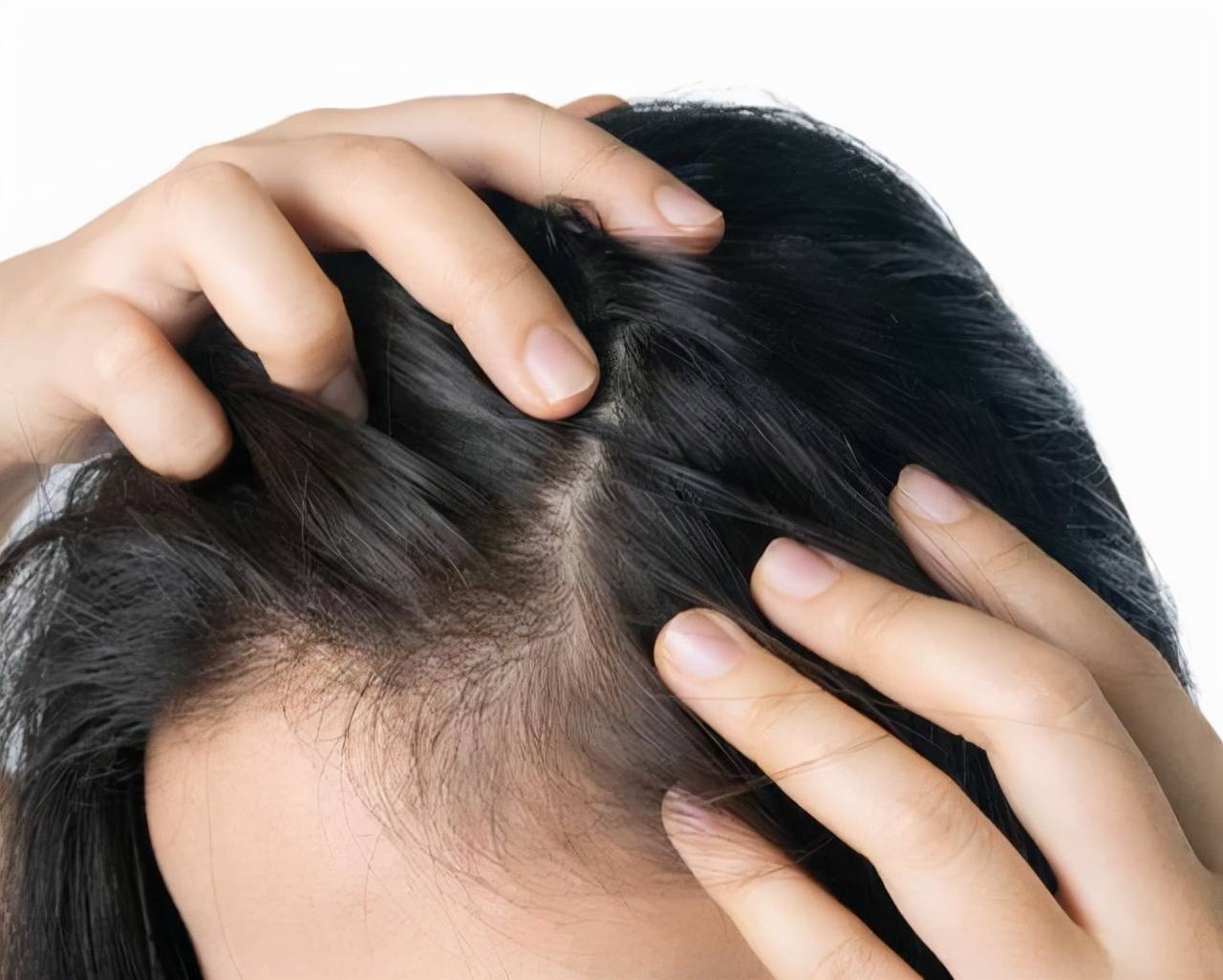 用什么可以去头上的虱子 ba4f1b98d7a543a8bf8391fd9c4705bd.jpeg