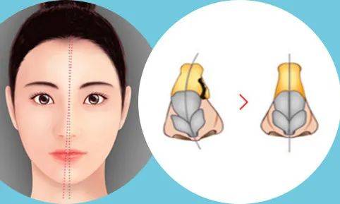 损伤|成都民生耳鼻喉医院提示：别把「涕中带血」不当回事