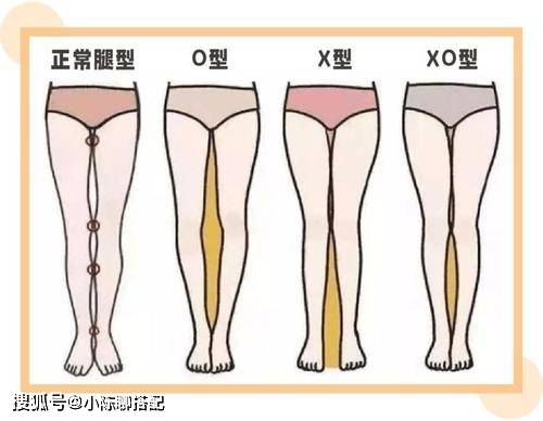 不同的腿型包容程度是不一样的