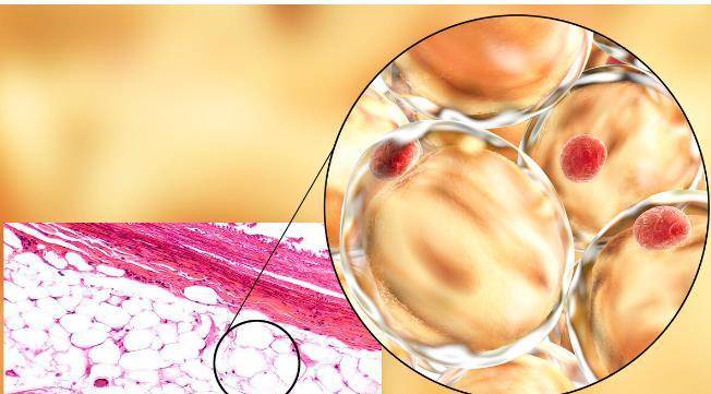 他汀|降脂新药依折麦布，疗效明确不伤肝，他汀好搭档，6类人特别适用