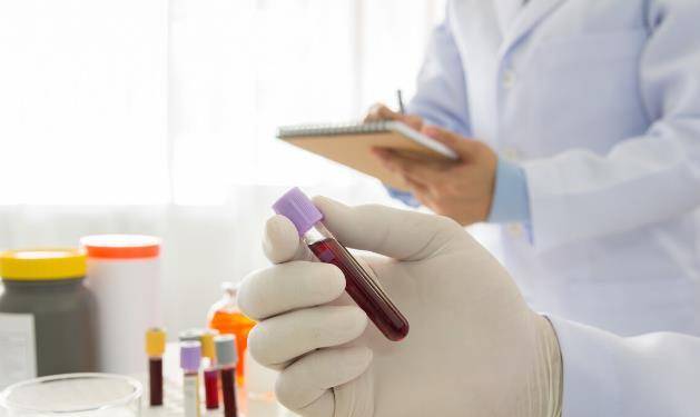 免疫球蛋白igg低还是高好 30d1f277931c486d80ecef1a0f093946.jpeg