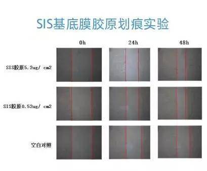 补充为什么SIS基底膜胶原可以促进胶原分泌？这就来为你揭晓！