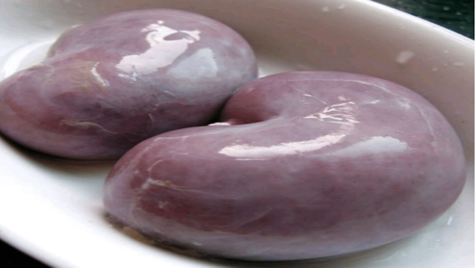 肾脏|为什么猪和人能移植肾脏？猪肾移植人体，正常工作了54小时