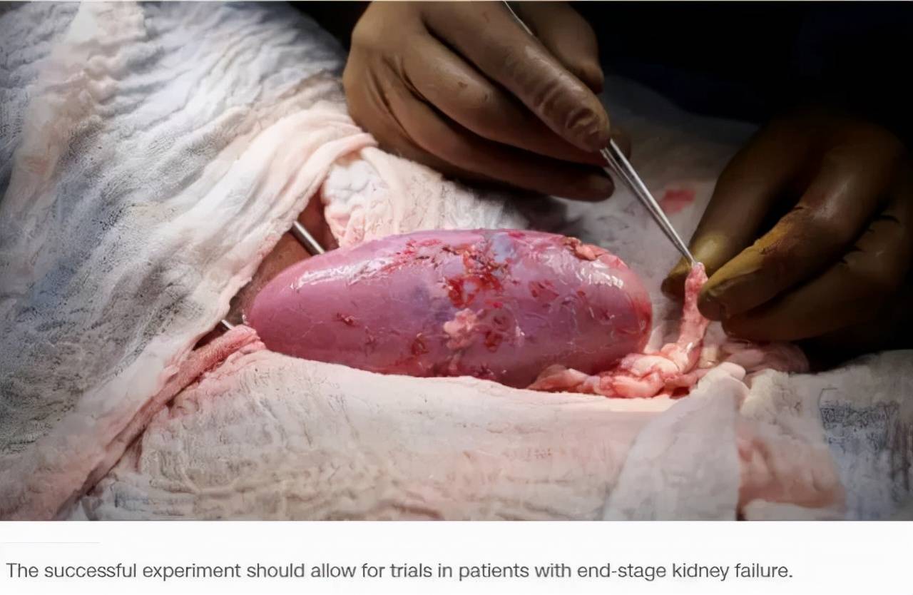 保存,異種腎移植手術並非為了拯救患者,只是一次在人體進行的技術驗證