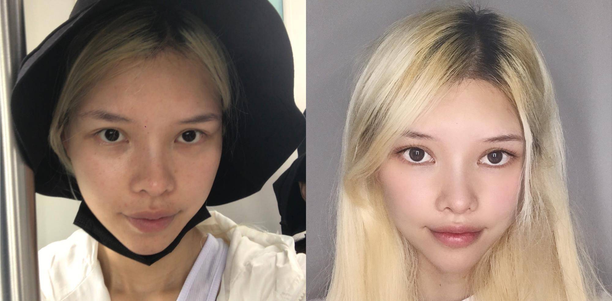 因为皮肤暗沉粗糙怎么办？