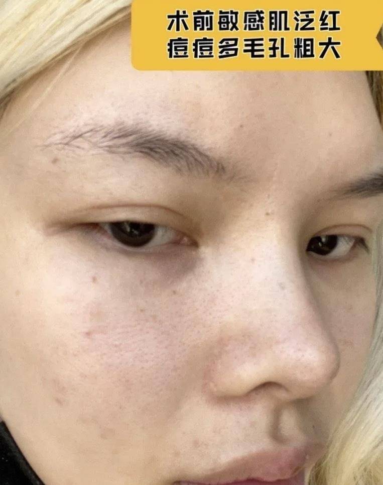 产品新手必看｜水光基础搭配逻辑全在这