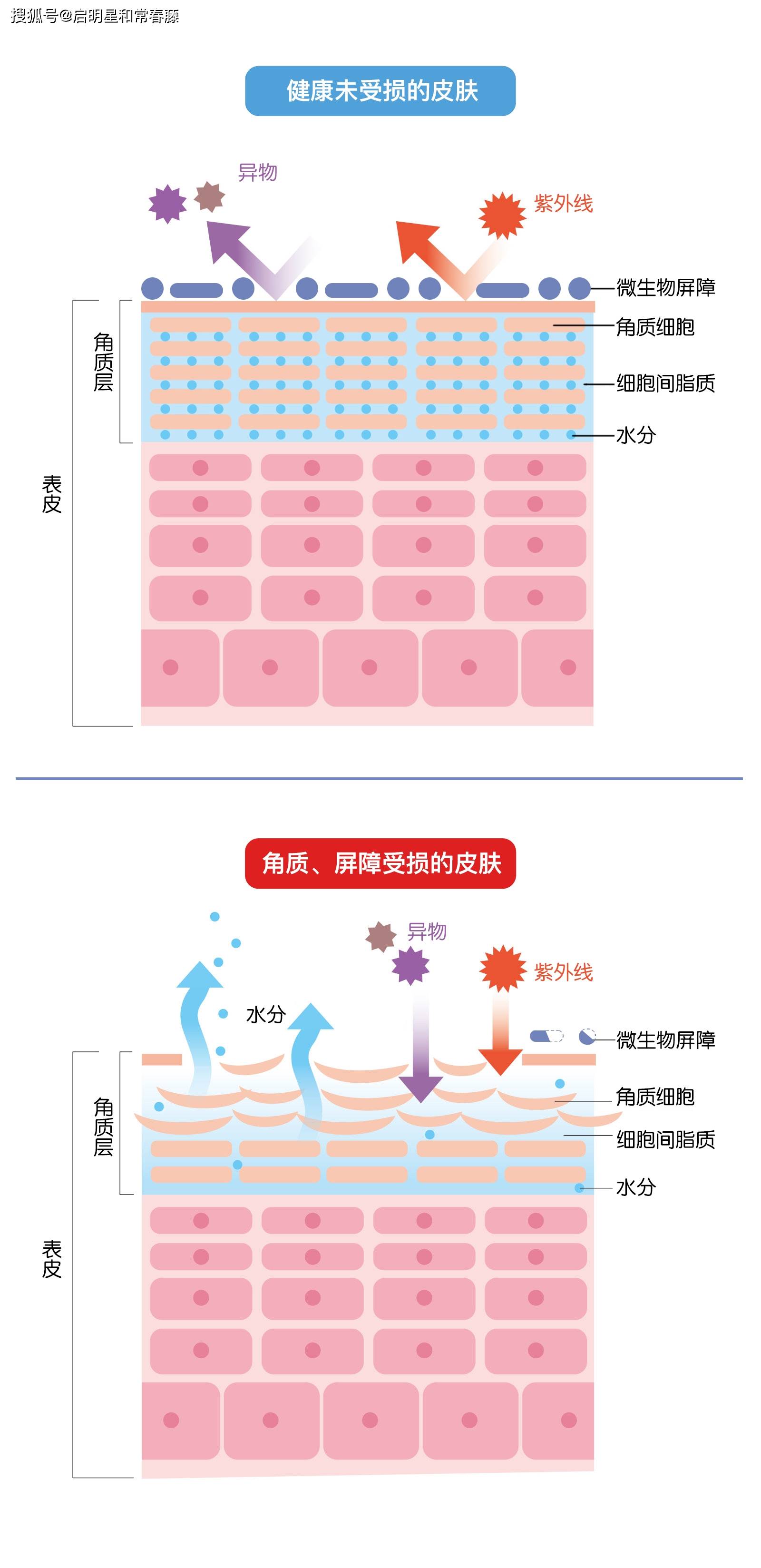 产品受损肌肤者应如何正确地清洁皮肤