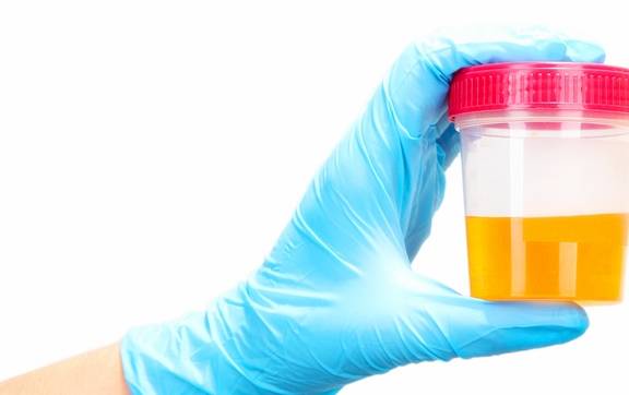 控制|糖尿病患者的尿又黄又骚是什么原因？你真的知道吗？看专家的理解