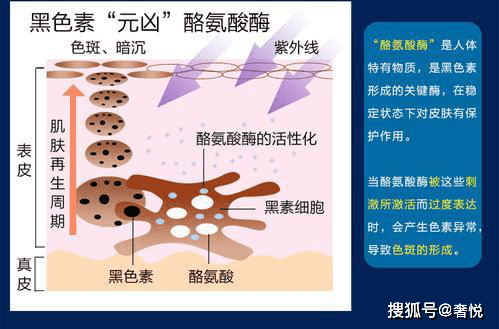 生活奢悦说：为什么脸上会长斑？搞清楚原因，能解决80%以上问题