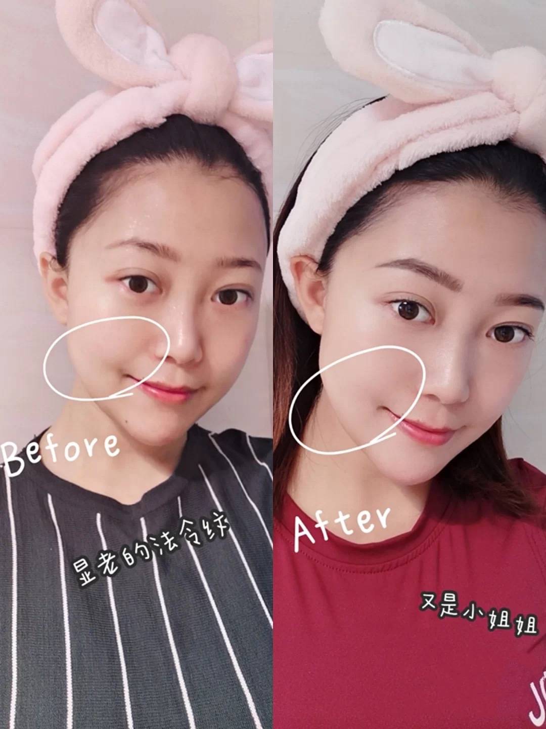 青春怎么消除法令纹？坚持六个小习惯，守住你的青春和美丽