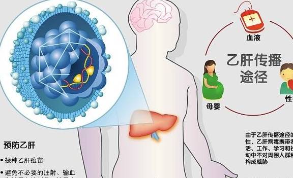 婴儿|“乙肝大国”的称号是怎么来的?乙肝传播风险无处不在?