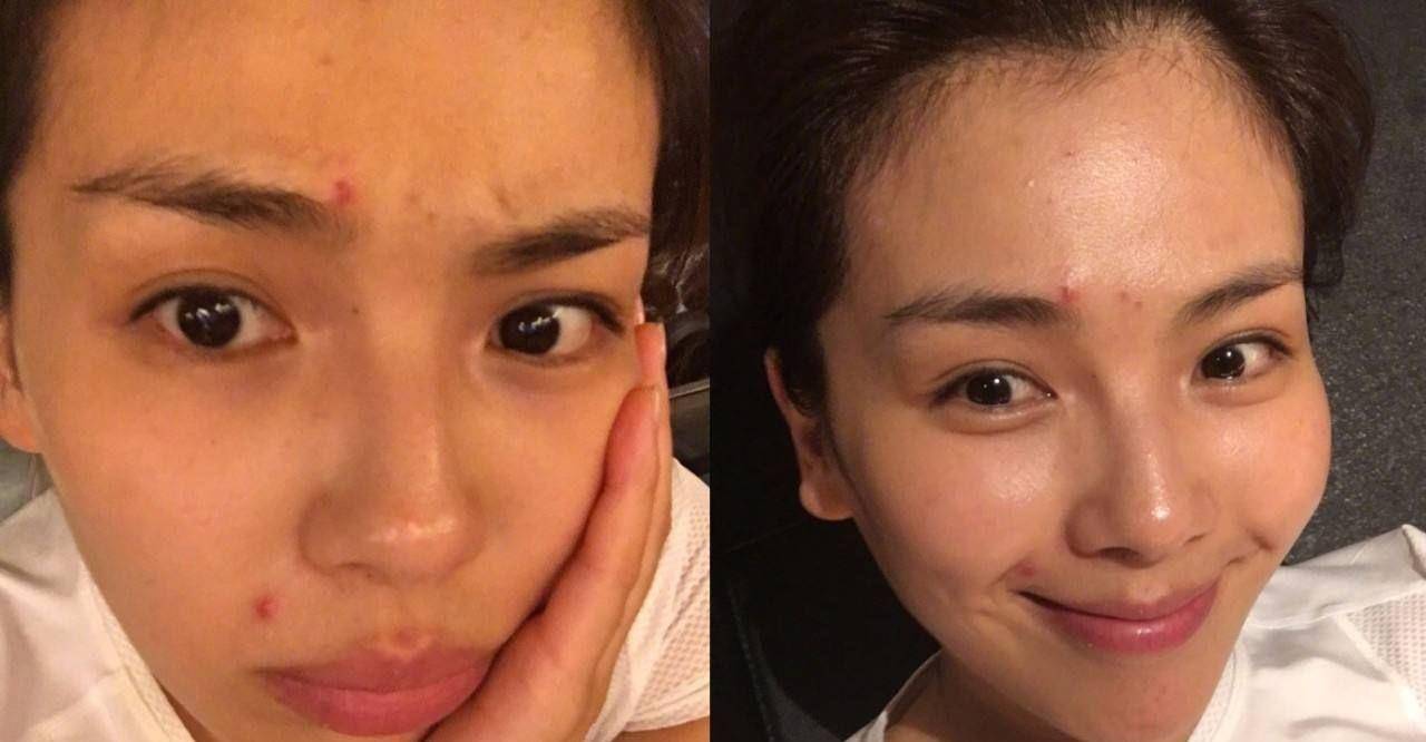 因为「俊颜说」为什么素颜女孩的皮肤比长期化妆的女孩好多了？