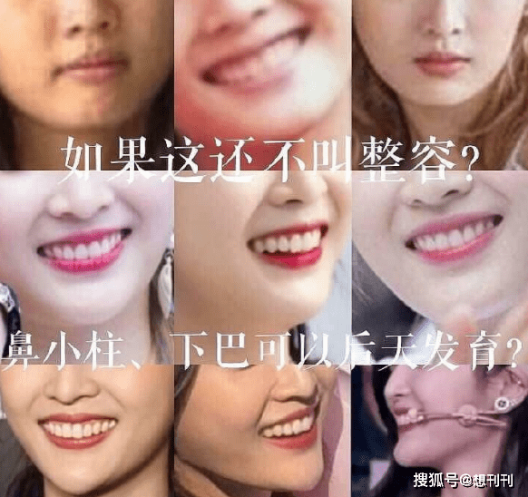 整容还是颜值bug这9个女星漂亮却怪异怪的五花八门