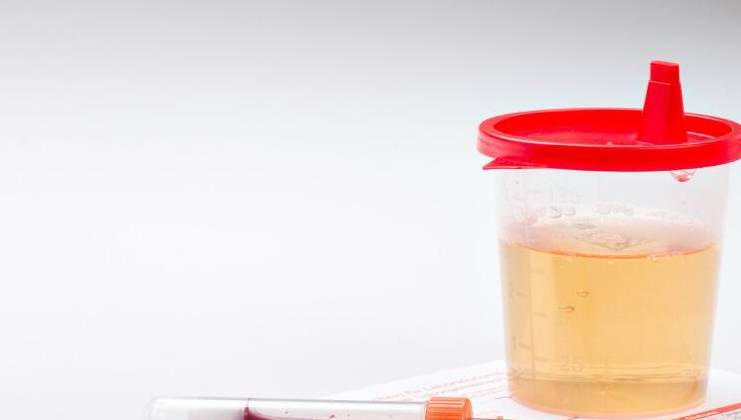 红细胞|肾病是否好转如何判断？8个信号是标准，肾功能好坏一目了然