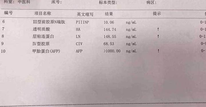 hbv-dna|48岁查出肝损伤,一年后发现早期乙肝肝硬化,早期肝硬化能治好吗