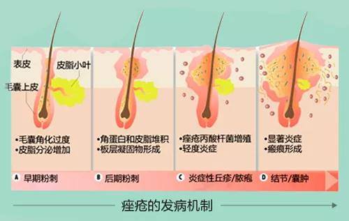 毛孔易烊千玺因脸上长痘在线撒娇