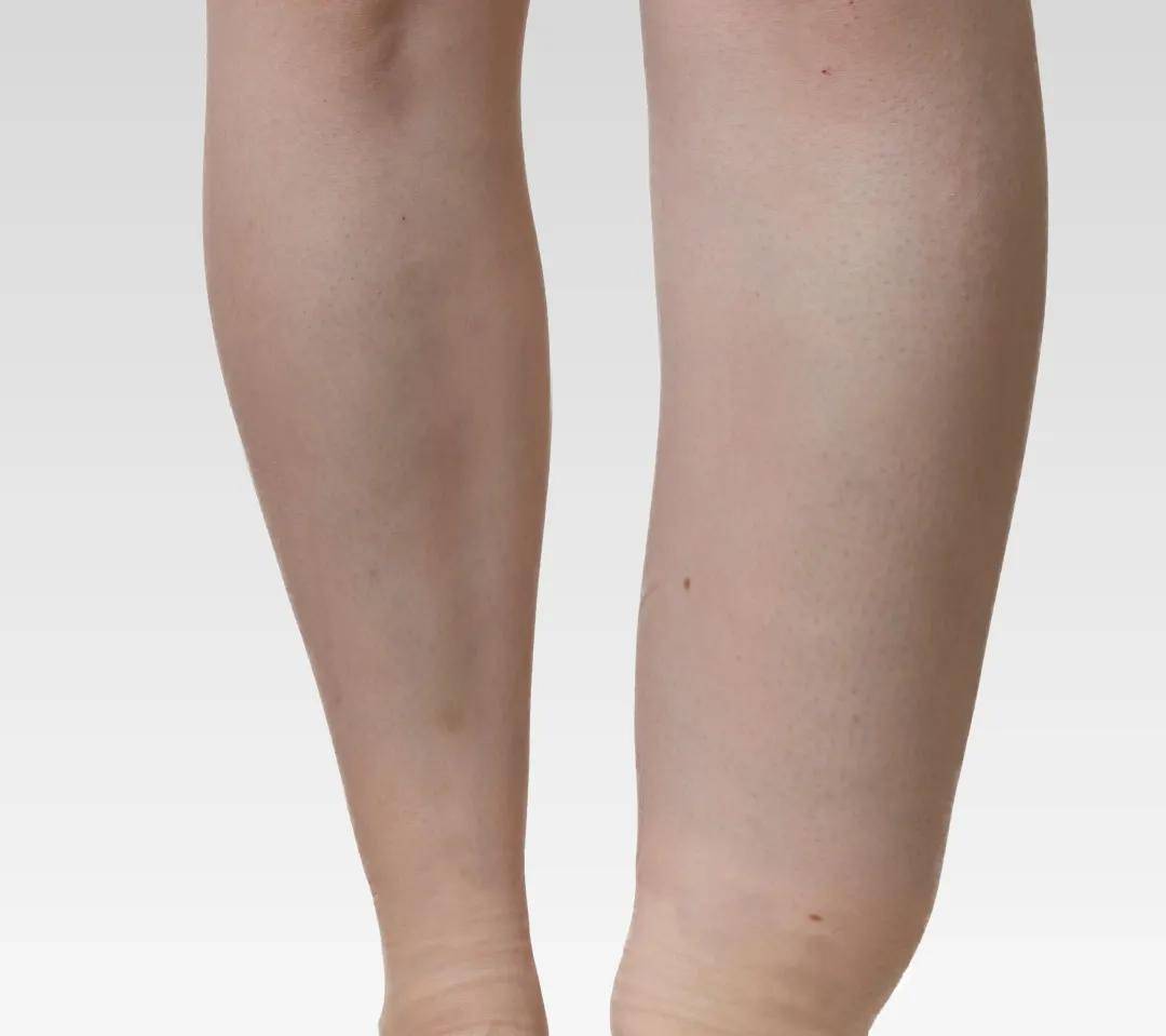 嗜茶|喝茶导致体重狂涨，医生找到了这个蛛丝马迹