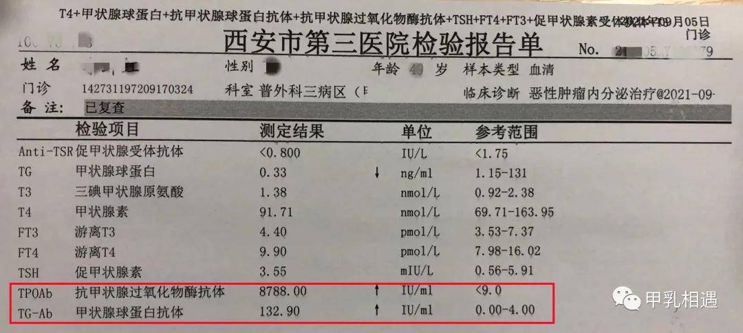 发展缓慢|不需“消炎”的炎症｜桥本氏甲状腺炎