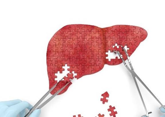 治愈|乙肝能治愈吗?治疗乙肝,这几件事要上心