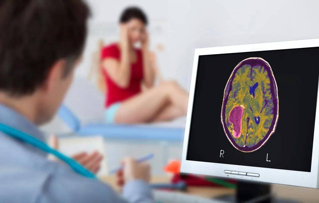 里长|脑袋里长这种瘤是不是100%没救了?看完这篇文章你就明白了！