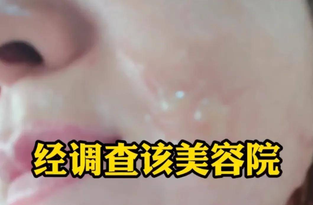 玛吉上海女子花两万元做医美，惨遭毁容烂脸，所谓进口设备全是假货