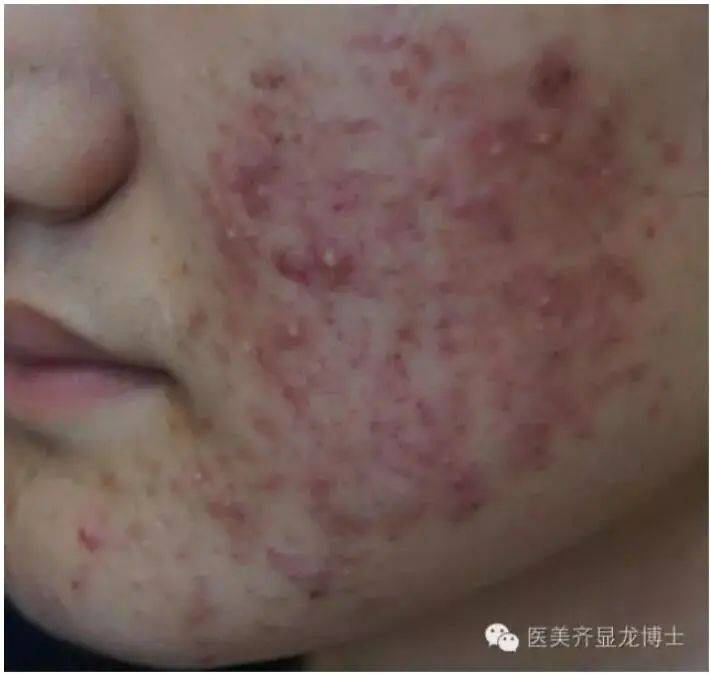 治疗齐显龙博士：敏感皮肤治疗和护理指南