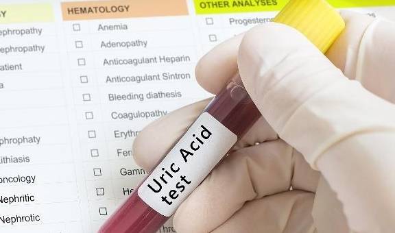 尿酸|一种“家常菜”是高尿酸祸根，控制尿酸水平，这2件事很重要