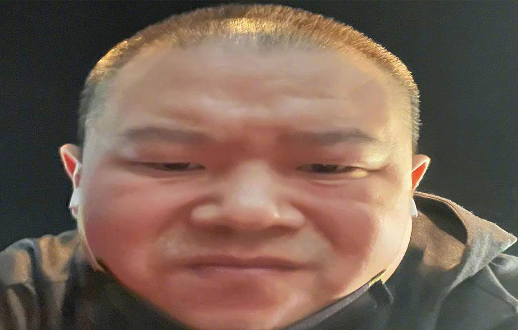 36岁男星传病情加重(暴瘦剃光头),现身近况网友担心_岳云鹏