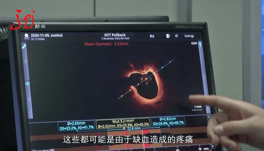 抢救|一女子突然倒地昏厥，“大白”跪地抢救……严寒心脏该如何保养？
