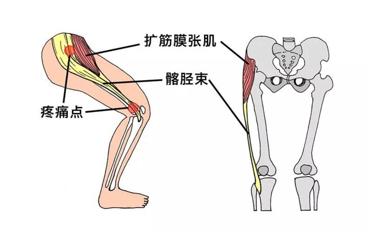 长文细说马拉松跑者告诉你筋膜枪该怎么选