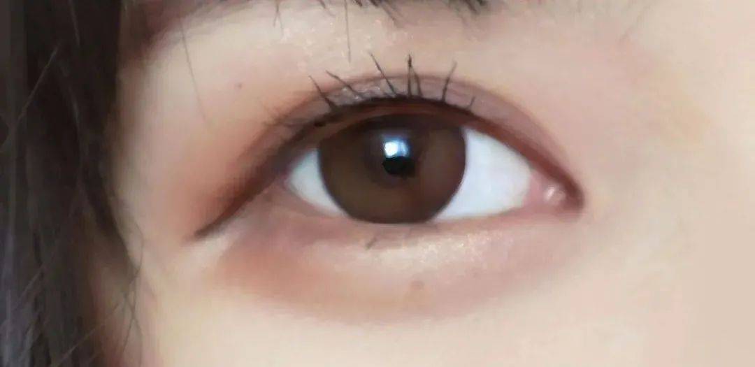 小逸提升变美不可兼得？和射频提升相比，传统拉皮手术对面部有哪些影响？