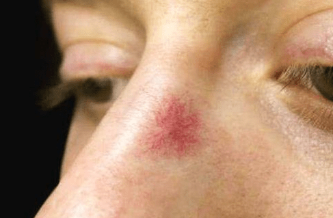 肝脏|肝脏“被搞坏”这5个部位会投诉你！做好3件事，肝脏才能好受