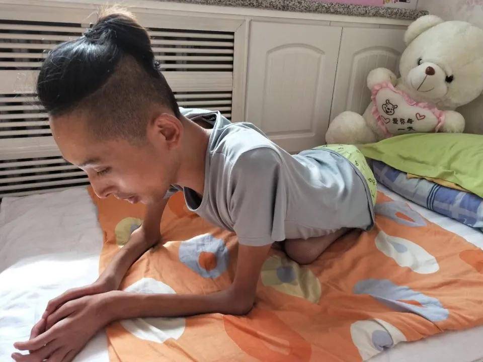 功能|渐冻人可以活多久 小心这些因素导致渐冻症