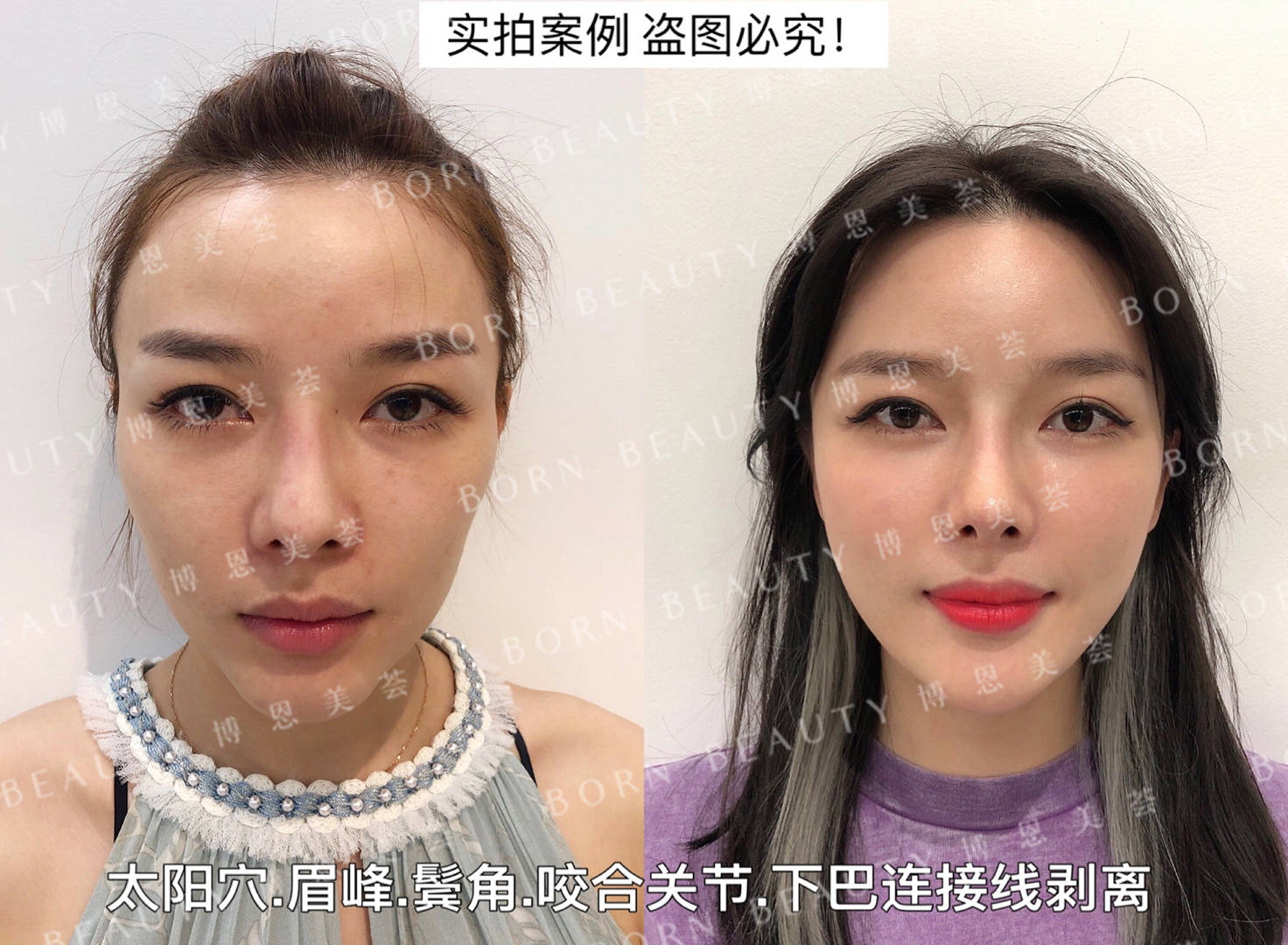 路线清纯小花怎么变成这样了？她到底动了哪里？