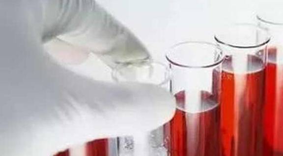 活动|这四类人肾脏很容易坏掉，警惕三种表现，做好三件事，肾会变好！