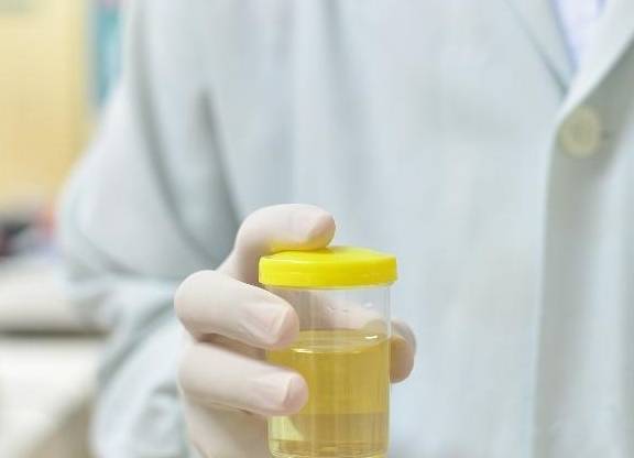 功能|排尿时发现这4个“蹊跷”,可能是肝发出的“通知”