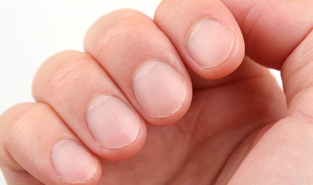 进行|手上若有这3个“标记”的人，恭喜，肝还算健康，不妨自测一下