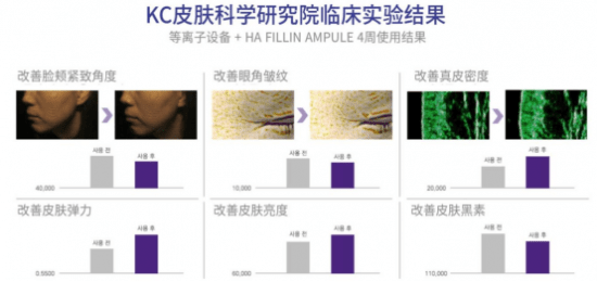 因为在家护肤美容仪器首选Plinic等离子美容仪