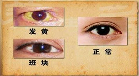 男女|不论男女，脸上若出现这4个“异常”，暗示肝脏受损