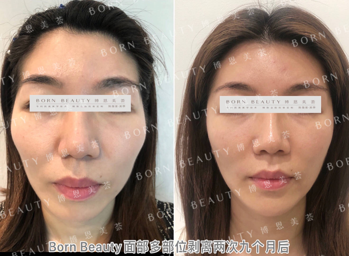 苹果逢亮相必热搜，唐嫣状态满分的秘密武器原来靠的是它！