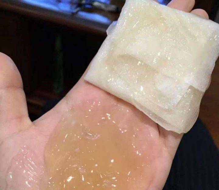 护肤品热搜第一!护肤品用得越多皮肤可能越差?孕期精简护肤才是王道!