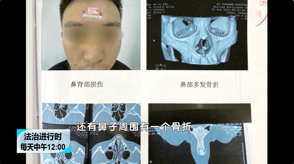 比赛|足球比赛时打伤对方球员，要承担刑责？