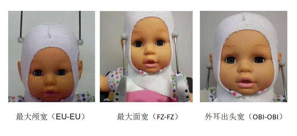 婴儿先天性头颅畸形宇航博士矫正帮助你